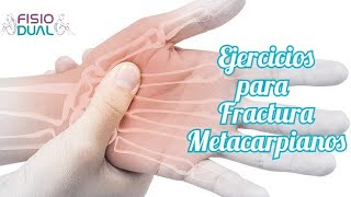 Ejercicios para FRACTURA METACARPIANOS huesos mano [upl. by Aileahcim]