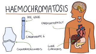 Understanding Haemochromatosis [upl. by Riobard617]