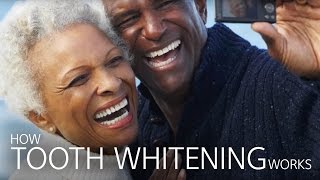 How Tooth Whitening Works [upl. by Eendys711]