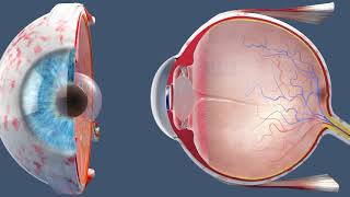 Cataract Surgery  Inside the OR [upl. by Nahgaem]