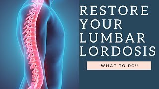 RESTORE Lumbar Lordosis amp The Curvature Of The Spine With These Exercises How To Demo [upl. by Beryl]