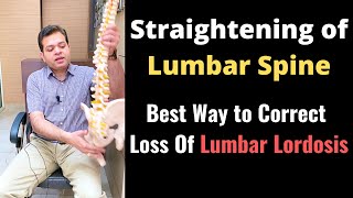 Straightening of Lumbar Spine Loss of Lumbar Lordosis Treatment How to Correct Lumbar Curvature [upl. by Oxley]