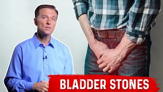 What causes kidney stones  Arash Shadman [upl. by Sadler585]