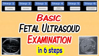 Basic Fetal Ultrasound Examination [upl. by Harikahs535]