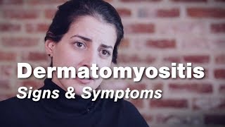 Dermatomyositis Review shorts [upl. by Egiaf]