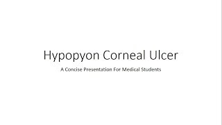 Hypopyon Corneal Ulcer Ophthalmology  For Medical Students [upl. by Tandie]