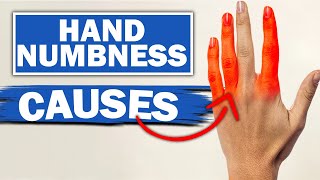 Top 3 Causes For Numbness In Your Fingers [upl. by Kono]