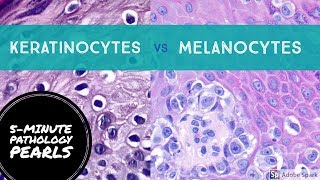 Melanocytes vs Keratinocytes Made Easy 5Minute Pathology Pearls [upl. by Nivlem]