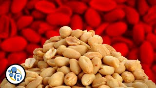 The Truth About Peanut Allergies [upl. by Oileduab]