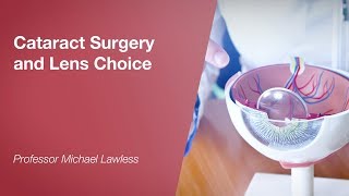 Cataract Surgery and Lens Choice [upl. by Onabru]