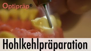 Tutorial Hohlkehlpräparation mit Optipräp® [upl. by Rakso]