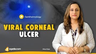 Viral Corneal Ulcer  Ophthalmology Online Lecture  Medical Student  VLearning [upl. by Kelci]