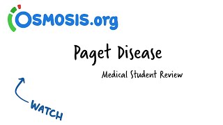 Paget Disease Osmosis Study Video [upl. by Nev]