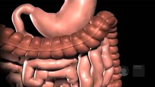 Gastric bypass in het Obesitascentrum Catharina Ziekenhuis [upl. by Aineval]