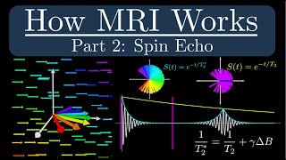 How MRI Works  Part 2  The Spin Echo [upl. by Amled424]