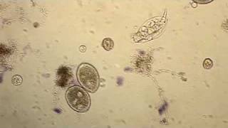 Wastewater Ciliates [upl. by Areemas]