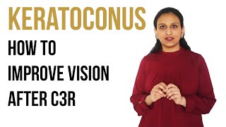 Keratoconus FAQs  केरेटोकोनस में C3R के बाद नज़र कैसे अच्छी होगी  CLIO Eye Care [upl. by Esnahc]