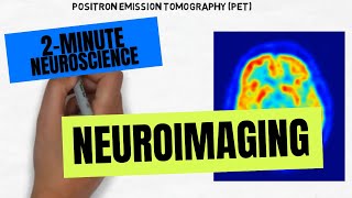 2Minute Neuroscience Neuroimaging [upl. by Dorita]