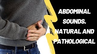 Abdominal Sounds Natural And Pathological [upl. by Nednarb]