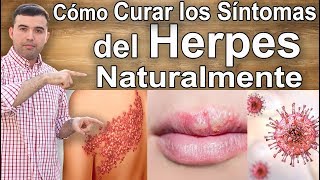 Cómo Curar y Tratar El Herpes Naturalmente [upl. by Corrine]