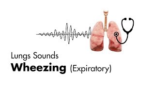 Wheezing expiratory  Lung Sounds  MEDZCOOL [upl. by Rosenstein828]