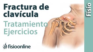 FRACTURA de CLAVÍCULA Rehabilitación ejercicios y tiempo de RECUPERACIÓN [upl. by Seline712]