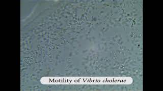 Motility of Vibrio cholerae [upl. by Buroker]