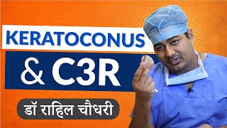 Keratoconus and C3R Corneal Cross Linking Treatment In Hindi [upl. by Nimoynib941]