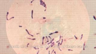 Corynebacterium diphtheriae amp Diphtheria [upl. by Sedicla]