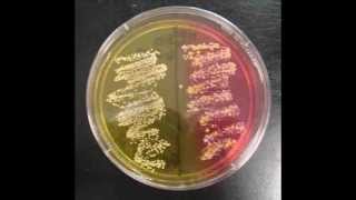 How to Interpret Mannitol Salt Agar Bacterial Growth Medium [upl. by Eupheemia]