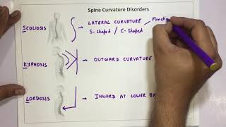 Spine Curvature Disorders  Scoliosis Kyphosis Lordosis [upl. by Valdemar]