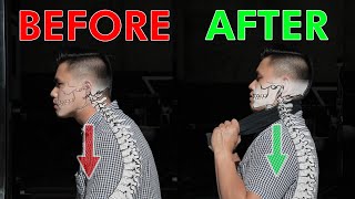 Restore Your Neck Posture amp Curve  Cervical Lordosis [upl. by Deeas]