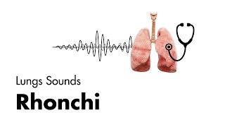 Rhonchi  Lung Sounds  Medzcool [upl. by Cecelia]