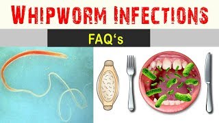 Whipworm infections  Frequently Asked Questions And Answers [upl. by Ainehs]