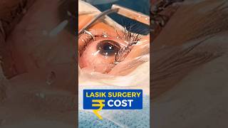 LASIK Surgery Cost [upl. by Toile580]