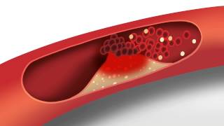 How to Read amp Understand Your Cholesterol Numbers [upl. by Bourque]