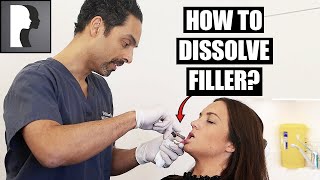 How to dissolve filler [upl. by Niriam821]