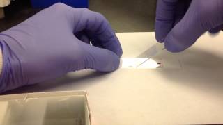 Hematology Making a Peripheral Blood Smear [upl. by Merill]