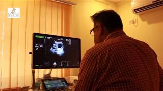 How To OB Ultrasound  Normal Pregnancy Case Study Video [upl. by Mayfield511]