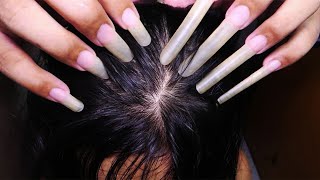 ASMR Intense Fast Scalp Scratching and Head Massage  Long Nails [upl. by Allekim]