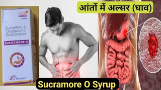 Sucramore O Syrup Benefits uses in Hindi  sucralfate syrup Oxetacaine syrup  Medical Gyan [upl. by Coumas]