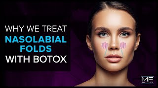 Using BOTOX® To Treat Nasolabial Folds at Mabrie Facial Institute [upl. by Holleran]