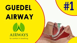 Guedel Airway  Oropharyngeal Airway [upl. by Ahseinaj]