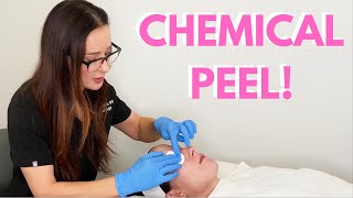 Performing a Glycolic Acid Chemical Peel  Dr Bartos Dermatology [upl. by Esetal]