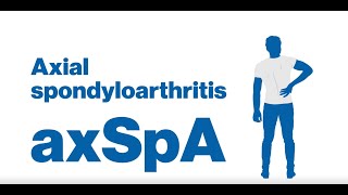 More than just back pain what is Axial Spondyloarthritis axSpA [upl. by Notniuqal]