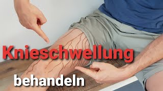 Lymphödem  Hirslanden amp TeleZüri Gesundheitssendung CheckUp [upl. by Kitchen692]