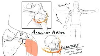 The Brachial Plexus II Animated Review HD [upl. by Akena]