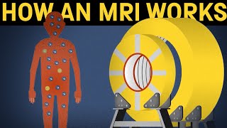 How does an MRI machine work [upl. by Anairuy]