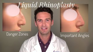 Liquid Rhinoplasty Everything you need to know [upl. by Belloir]