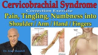 Cervicobrachial Syndrome Corrective Exercise Pain Burning into Shoulder Arm Hand  Dr Mandell [upl. by Ecydnarb]